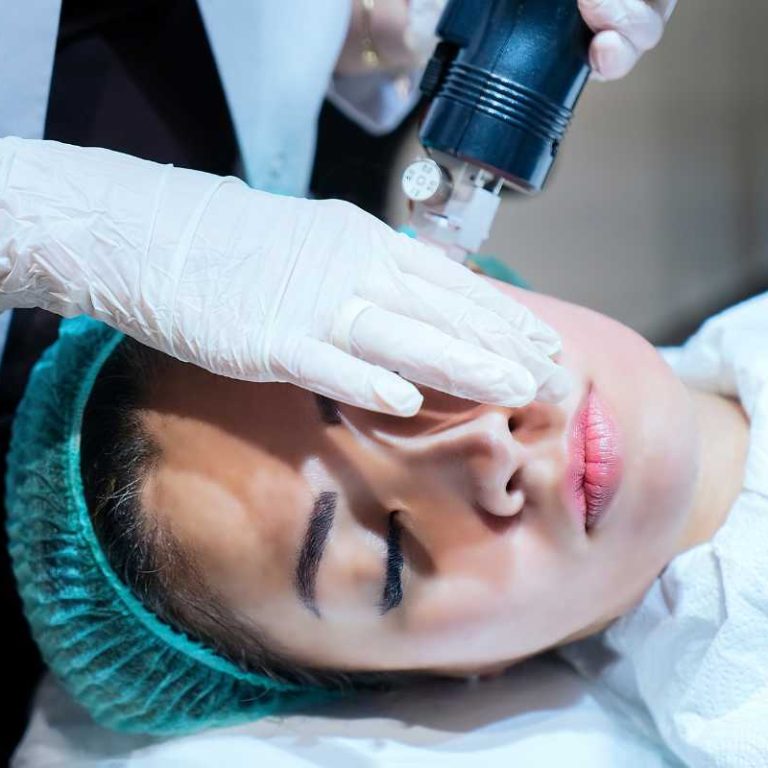 Morpheus and Skin Pen 1